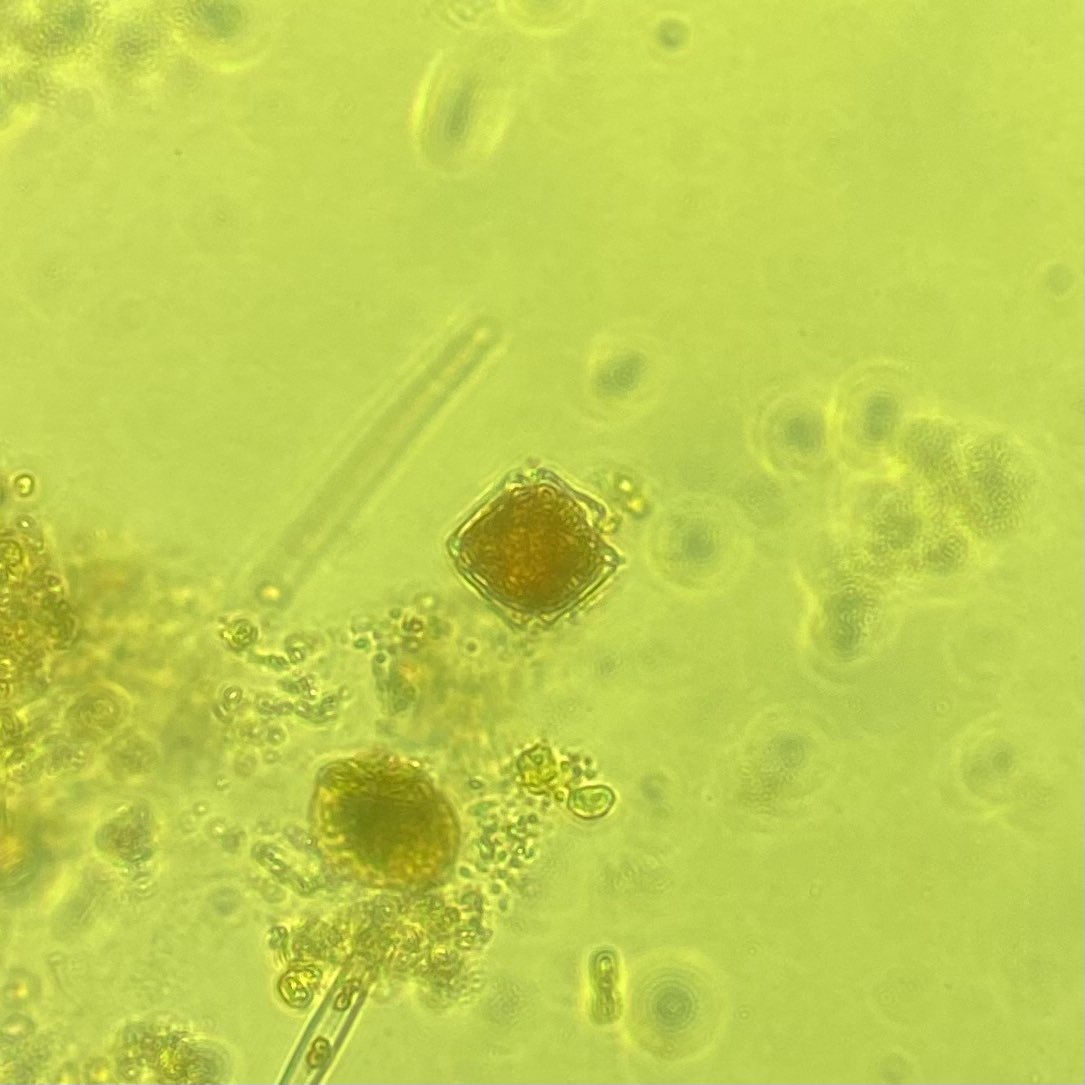 _Clarity3's tweet photo. ‘Ooh, look at the lobes on that dinoflagellate’ 👀 -things I say to myself alone in the lab #PhycologyFriday https://t.co/Qyu56wiSWQ