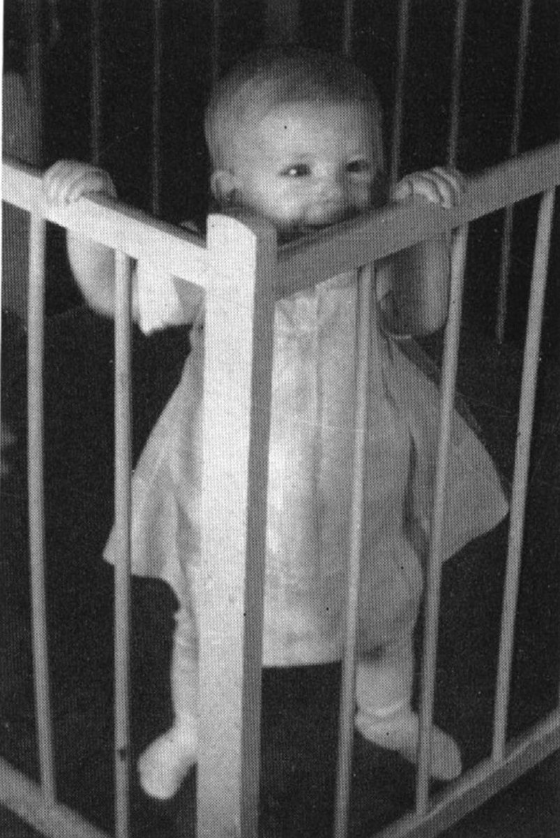 CirugiaPediaMx's tweet photo. Esta es la foto de la primer paciente que sobrevivió a la reparación de una atresia de esófago.
Fue operada por el Dr. Cameron Haight en 1941. Antes de ella había reportado 9 pacientes que habían fallecido. 
1er foto: 11 meses de edad. 2a foto: 16 años de vida.
#SoMe4PedSurg 👶🏻 https://t.co/gdfTas1I5i