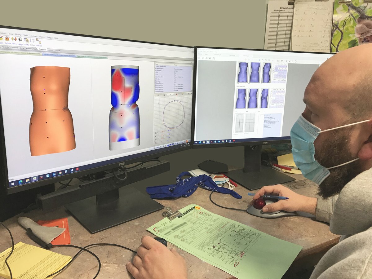 VorumResearch's tweet photo. Here’s Ben from Spinal Tech adjusting a #scoliosis patient’s shape! As Ben adjusts the patient's shape, he can also generate reports. With digital documentation, you can provide better patient care by having precise reports at any point in time of the patient's journey.

#oandp https://t.co/rZa0VOAeTy