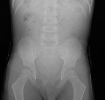 The American Registry of Radiologic Technologists (ARRT) has released their updated Examination Content Specifications for Radiography, effective Jan. 1st, 2022. 

One major change: Exam content will no longer include patient shielding.

Read more at: bit.ly/3stijQ2