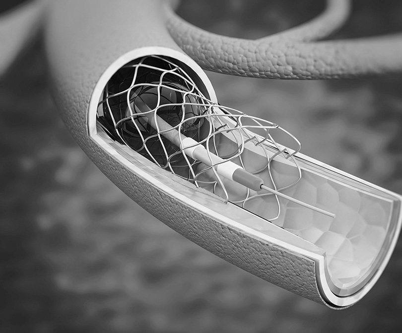 Cortland_Biomed's tweet photo. Today’s #biomedicaltextile structures can be engineered to be innovative enough to support and promote the healing and even the regeneration of damaged #cardiovascular tissue, with complex and fully customizable geometries. Learn more: https://t.co/wYY9aR5wlw https://t.co/lzEwX66aR3