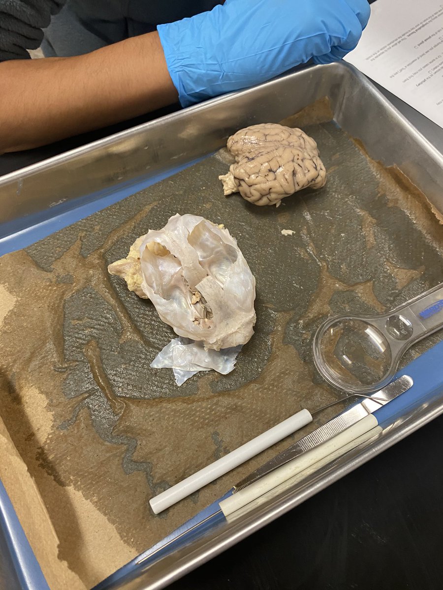 LHS Science Department (@lhs_science) on Twitter photo These <a href="/LOCKHARTHS/">Lockhart High School</a> Juniors used their brains today in an unusual way. Check out the cool disection in <a href="/TeachMsA/">Amanda Attales</a>’s Anatomy #CTE #Anatomy class. @CteLockhart These <a href="/LOCKHARTHS/">Lockhart High School</a> Juniors used their brains today in an unusual way. Check out the cool disection in <a href="/TeachMsA/">Amanda Attales</a>’s Anatomy #CTE #Anatomy class. @CteLockhart