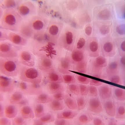 MercedelB's tweet photo. Fotos obtingudes avui, per l’alumnat de #biologia de l’@Guindavols, de cel•lules en plena reproducció. El que esta tenyit de rosa intens és l’#ADN, les estructures rodones són nuclis i les filiformes els #cromosomes. Us sona #mitosi? I #profase, #metafase, #anafase i #telofase? https://t.co/b9BppJkfU8