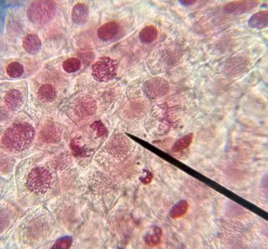 MercedelB's tweet photo. Fotos obtingudes avui, per l’alumnat de #biologia de l’@Guindavols, de cel•lules en plena reproducció. El que esta tenyit de rosa intens és l’#ADN, les estructures rodones són nuclis i les filiformes els #cromosomes. Us sona #mitosi? I #profase, #metafase, #anafase i #telofase? https://t.co/b9BppJkfU8