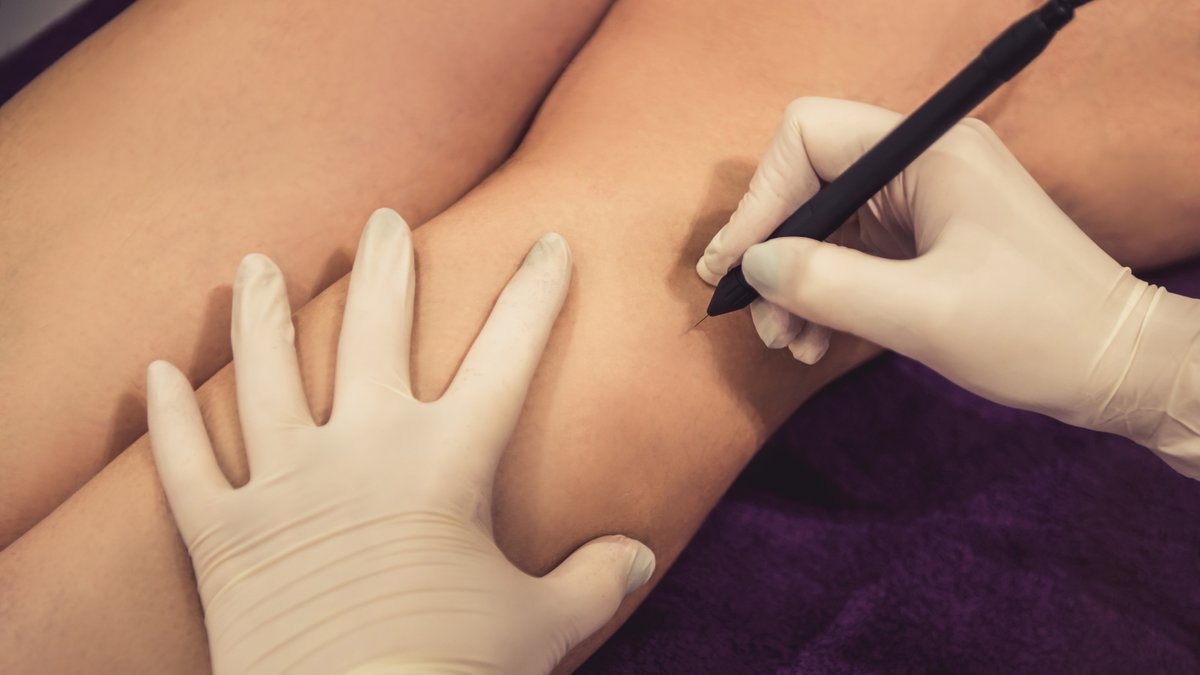 AIEElectrology's tweet photo. While interest in our industry continues to grow, there is still a lot to know about electrolysis and how it works. Find the facts here: 
https://t.co/s9svVvWTvQ
#electrolysishairremoval #permanenthairremoval #TheMoreYouKnow https://t.co/NxgqrYkV1y