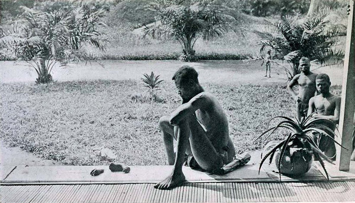 A Congolese man looking at the severed hand and foot of his five-year-old daughter who was killed, and allegedly cannibalized, by the members of Anglo-Belgian India Rubber Company militia.