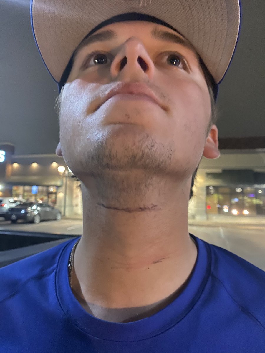 Reece Austin kills Coltin May!!