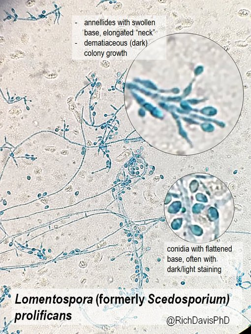 Stapes morphology (based on Hydropotes inermis NMB 9892). (A