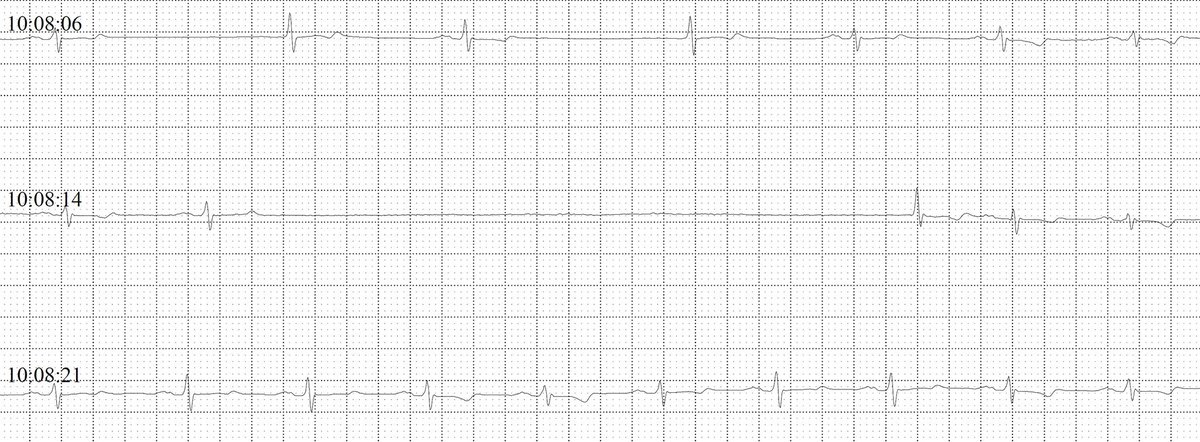 Looooong Sometimes you get BIG and looooong surprises in the clinic! A 72-year ...