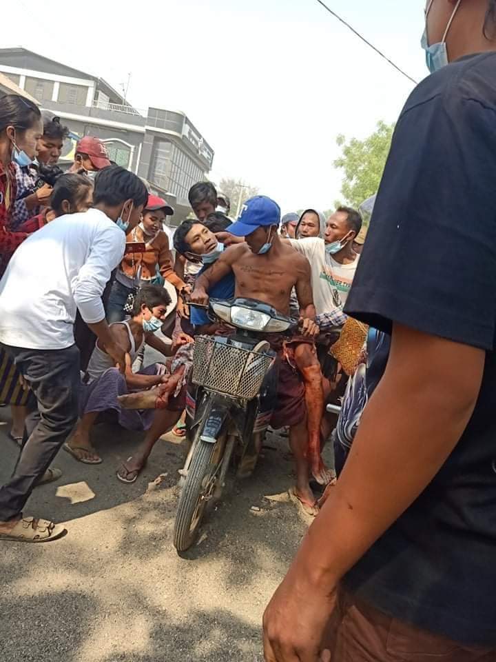 Tw//blood
At Magway!!!
Two people injured with live ammunition and a man reportedly dead due to violent opening gunfire of military terrorists in PhwintPhyu, Magway today.
ANTIFASCIST REVOLUTION
#WhatsHappeningInMyanmar  
#AntiFascistRevolution2021 #Mar27Coup