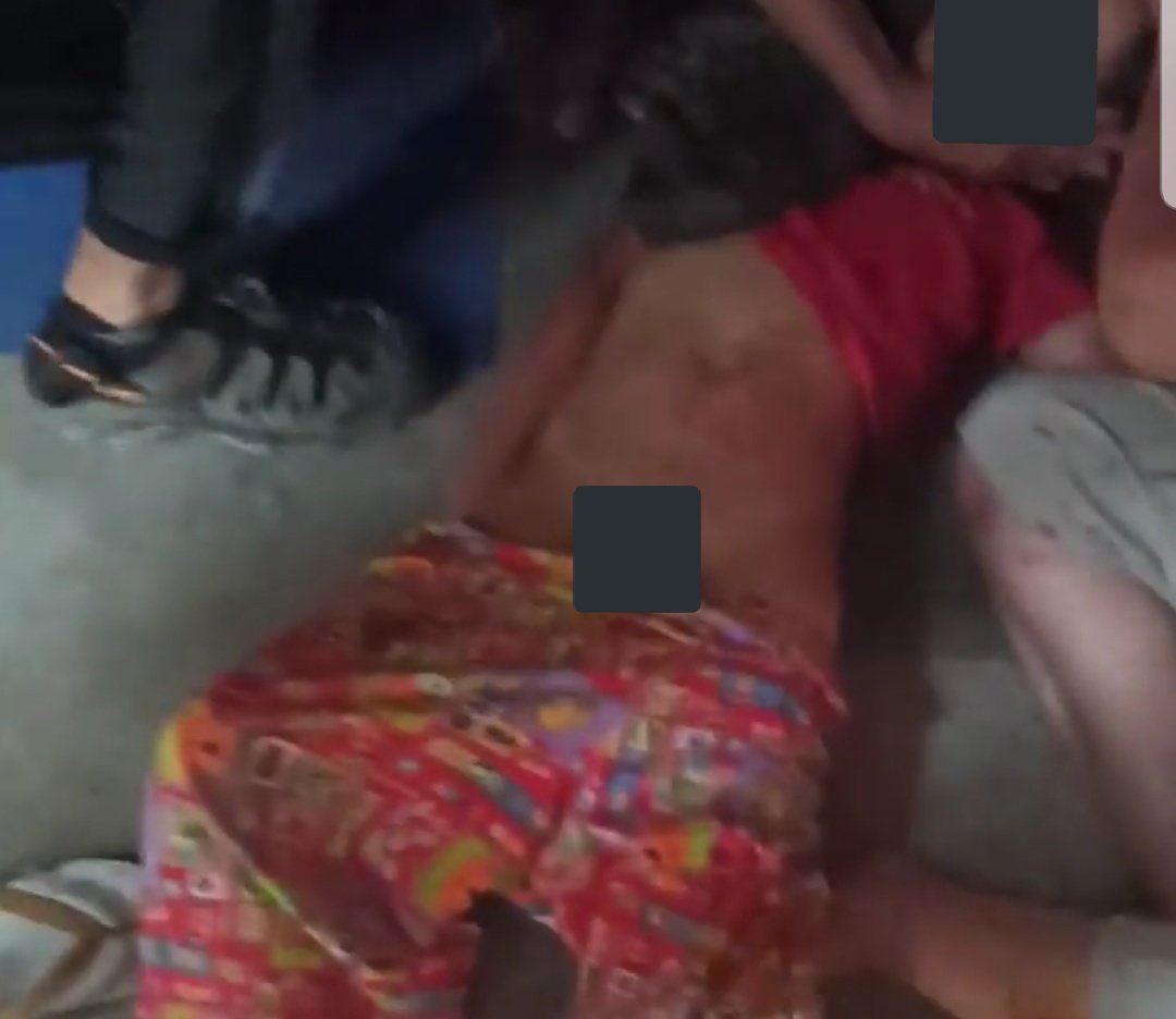 MayWongST's tweet photo. At least 10 children have now been killed in #Myanmar under #militarycoup since Feb 1. More reports of young under 18 yrs old losing their lives as #military security forces take action. Pic of a boy in #Mandalay reportedly shot in head. Condition unknown #WhatsHappeningInMyanmar https://t.co/pX6XA5ZI52