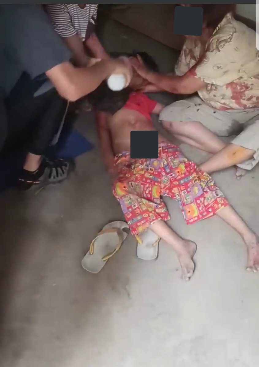 MayWongST's tweet photo. At least 10 children have now been killed in #Myanmar under #militarycoup since Feb 1. More reports of young under 18 yrs old losing their lives as #military security forces take action. Pic of a boy in #Mandalay reportedly shot in head. Condition unknown #WhatsHappeningInMyanmar https://t.co/pX6XA5ZI52
