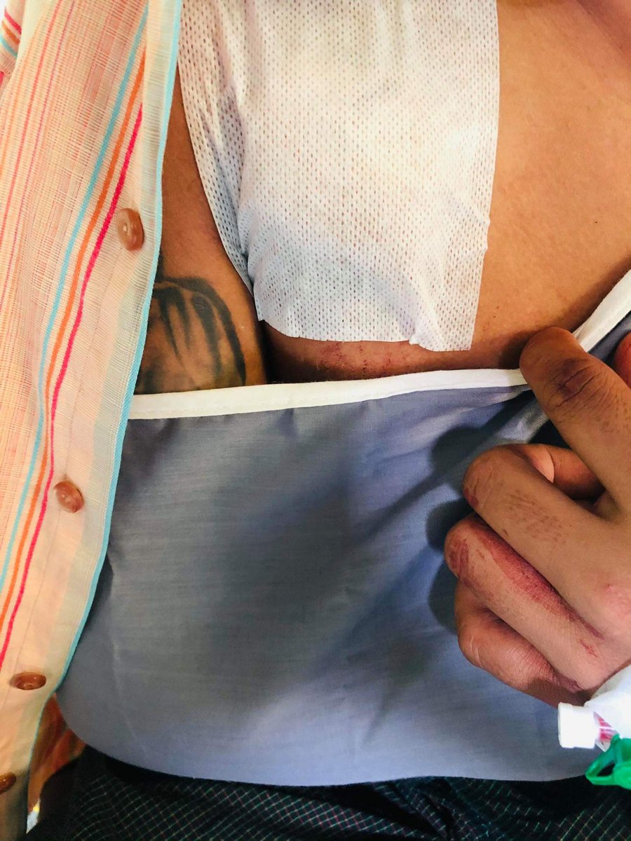Nyaung-U, Mandalay 

• 1 protester was shot dead by Terrorists (#Myanmar security forces)

• 5 seriously injured 

#WhatsHappeningInMyanmar #AntiFascistRevolution2021 #Mar27Coup #MilkTeaAlliance