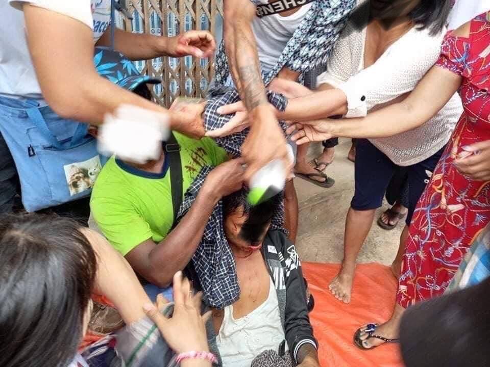 Pencilo4's tweet photo. tw // blood // wound
Protestors were shot in the head, leg, and waist by military terrorists at Bago City.
ANTIFASCIST REVOLUTION
#AntiFascistRevolution2021
#Mar27Coup
#WhatsHappeningInMyanmar https://t.co/Xlmb72QW1O