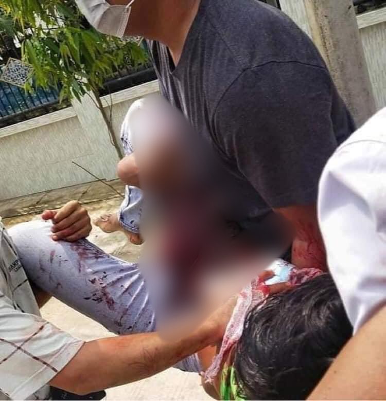 Pathein, Ayeyarwady Region: 

• Two young men were shot dead by Terrorists (#Myanmar security forces)

#WhatsHappeningInMyanmar #AntiFascistRevolution2021 #Mar27Coup #MilkTeaAlliance