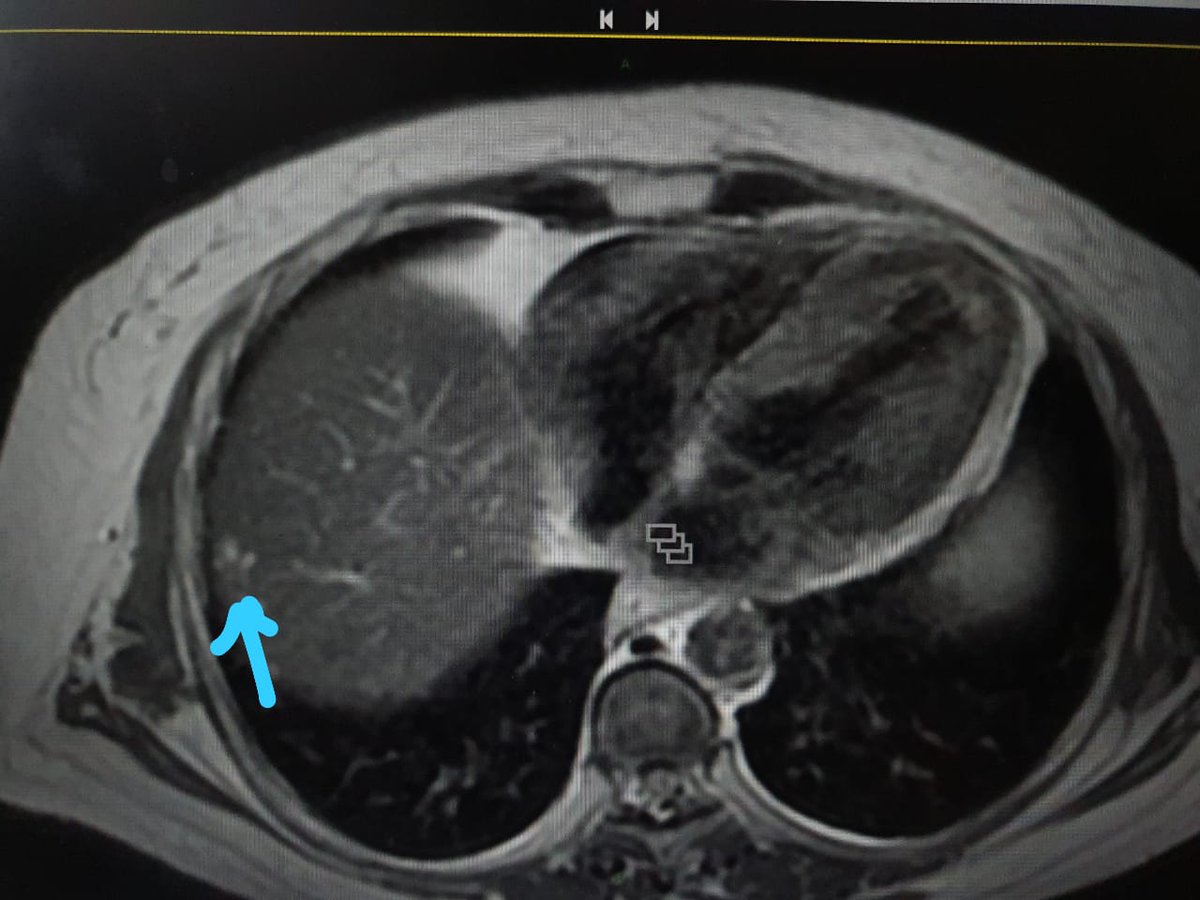 Nirmal Raut tweet media