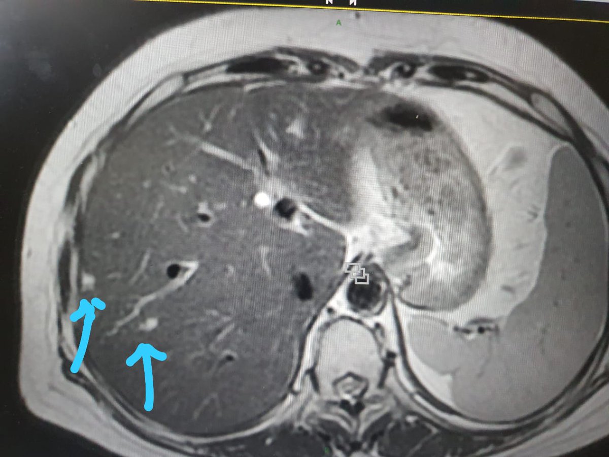 Nirmal Raut tweet media