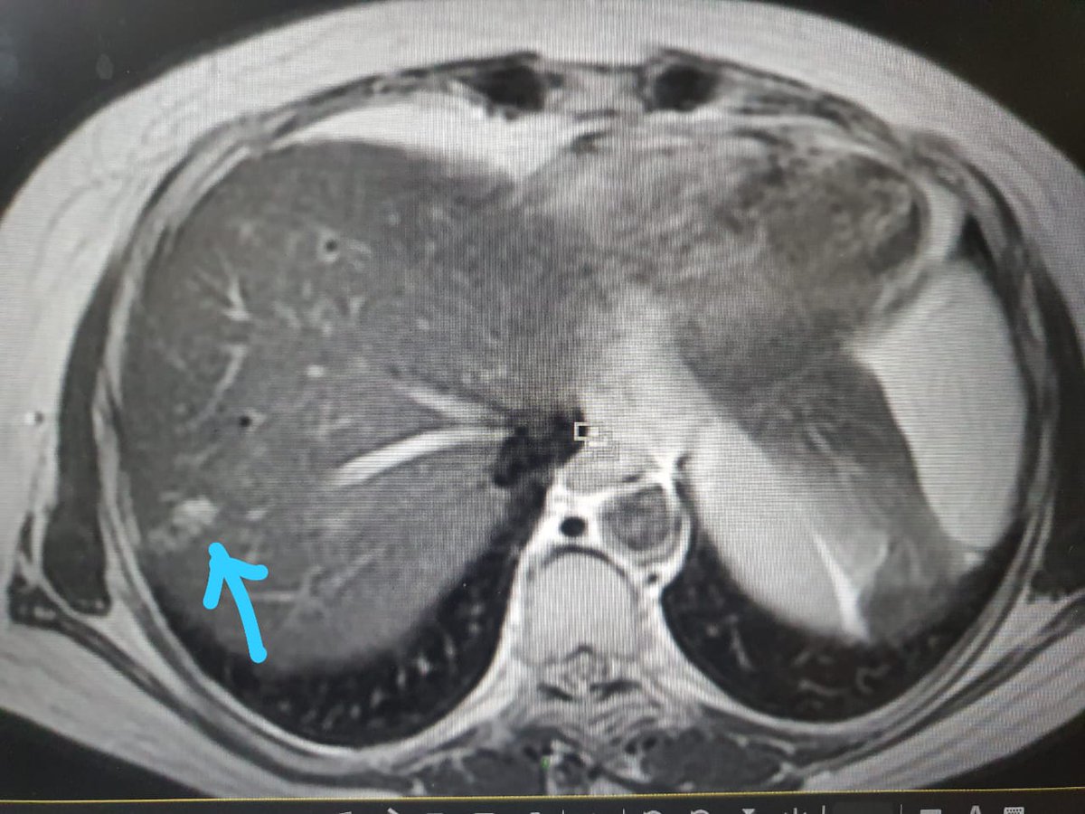 Nirmal Raut tweet media