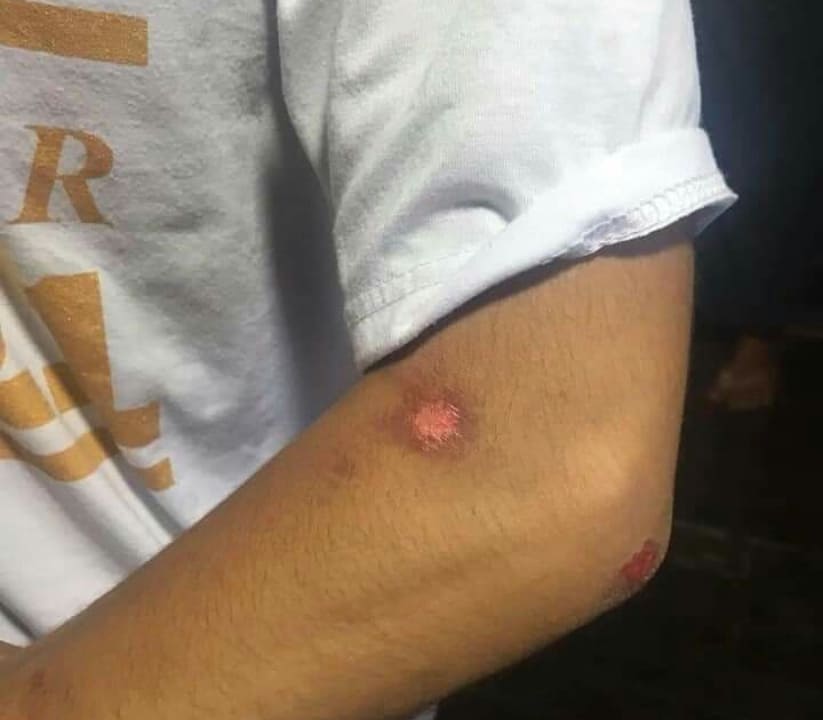 haymarn_tun's tweet photo. March 26 coup in Myeik.

The boys were arrested and beaten by the polices. 

#whatshappeninginmyanmar 
#crimesagainsthumanity 
#rejectmilitarycoupmyanmar 
#againstmilitarycoup https://t.co/85U1ghJIh9