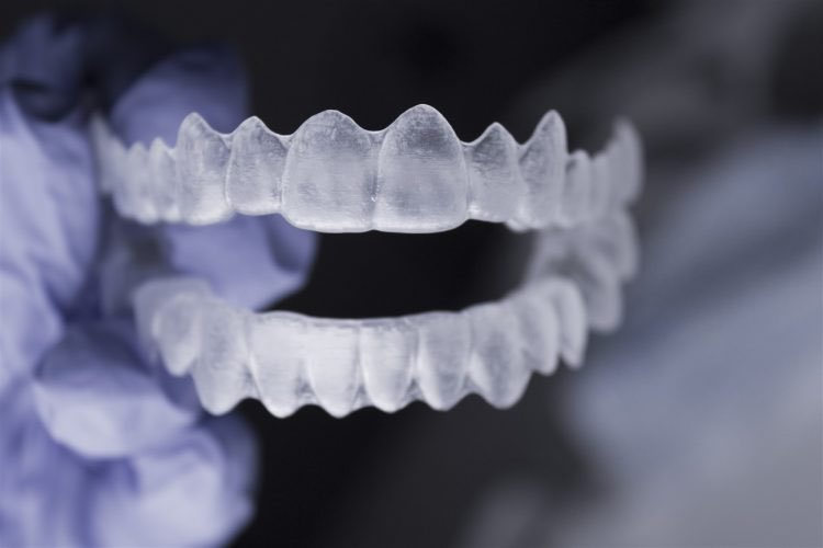doktordiscom's tweet photo. #draligner la diçleriniz düzelsin. #invisalign https://t.co/yykIp7UJEW