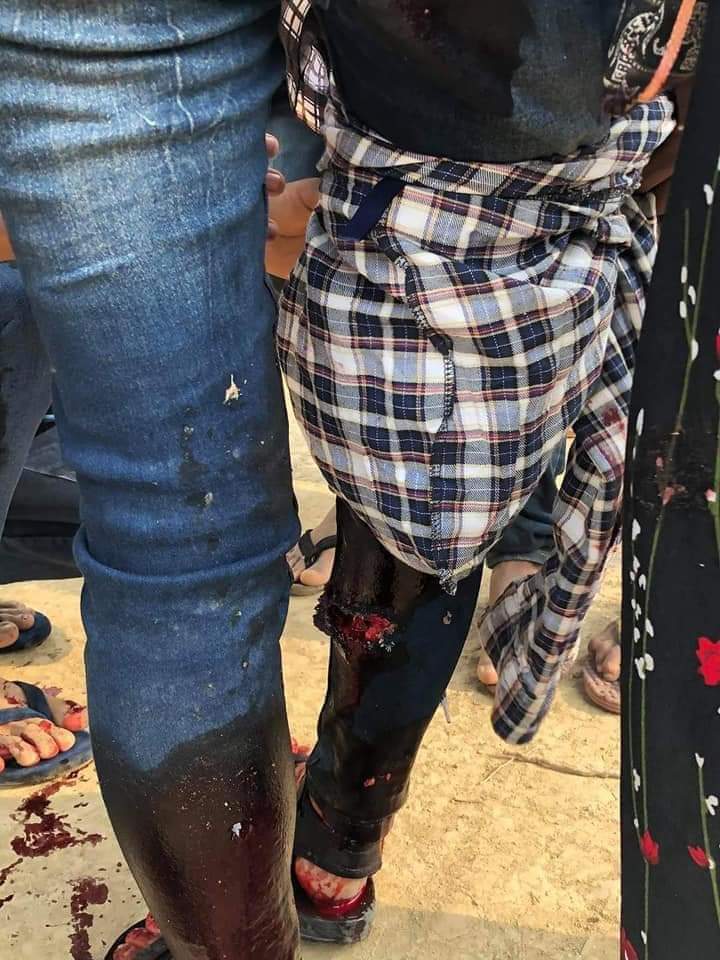 In Hpa Do, Bago;

One people reportedly dead and at least three injured due to violent shooting of military terrorists with live ammunition. tw // blood

ANTIFASCIST REVOLUTION
#WhatsHappeningInMyanmar  
#AntiFascistRevolution2021 #Mar27Coup