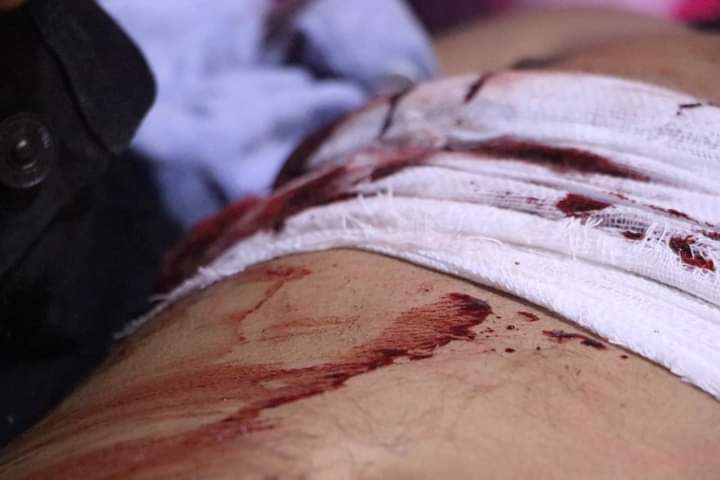 UPDATE SHAN NEWS: Because of the violent crackdown of #Lashio protest, four people, including a woman are now confirmed dead. However, the dead body of the woman got taken away by Facist Military.
#WhatsHappeningInMyanmar