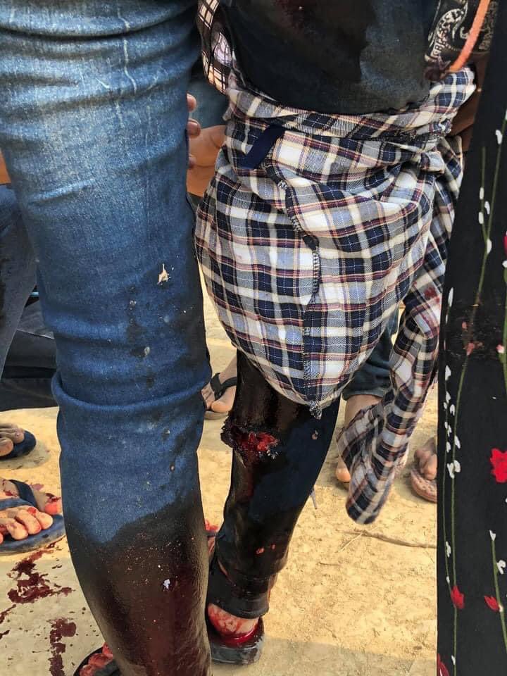 ChawSu00880278's tweet photo. Civilians are shot to head, legs by terrorists at #Phado #Bago. #WhatsHappeningInMyanmar #Mar27Coup @SkyNews @Juarawee @john_hq3 @MaryLawlorhrds https://t.co/jVr4hvbVs3