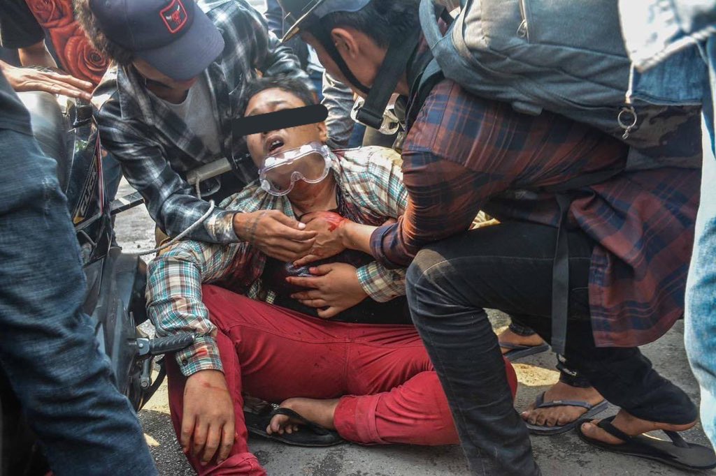 hmmo_sh's tweet photo. Tw// blood 
Mandalay, AungMyayTharSan strike was cracked down violently with live ammunitions by military junta forces. Many were injured reportedly.
#Mar27Coup #WhatsHappeningInMyanmar https://t.co/Lp2bRYv6r9
