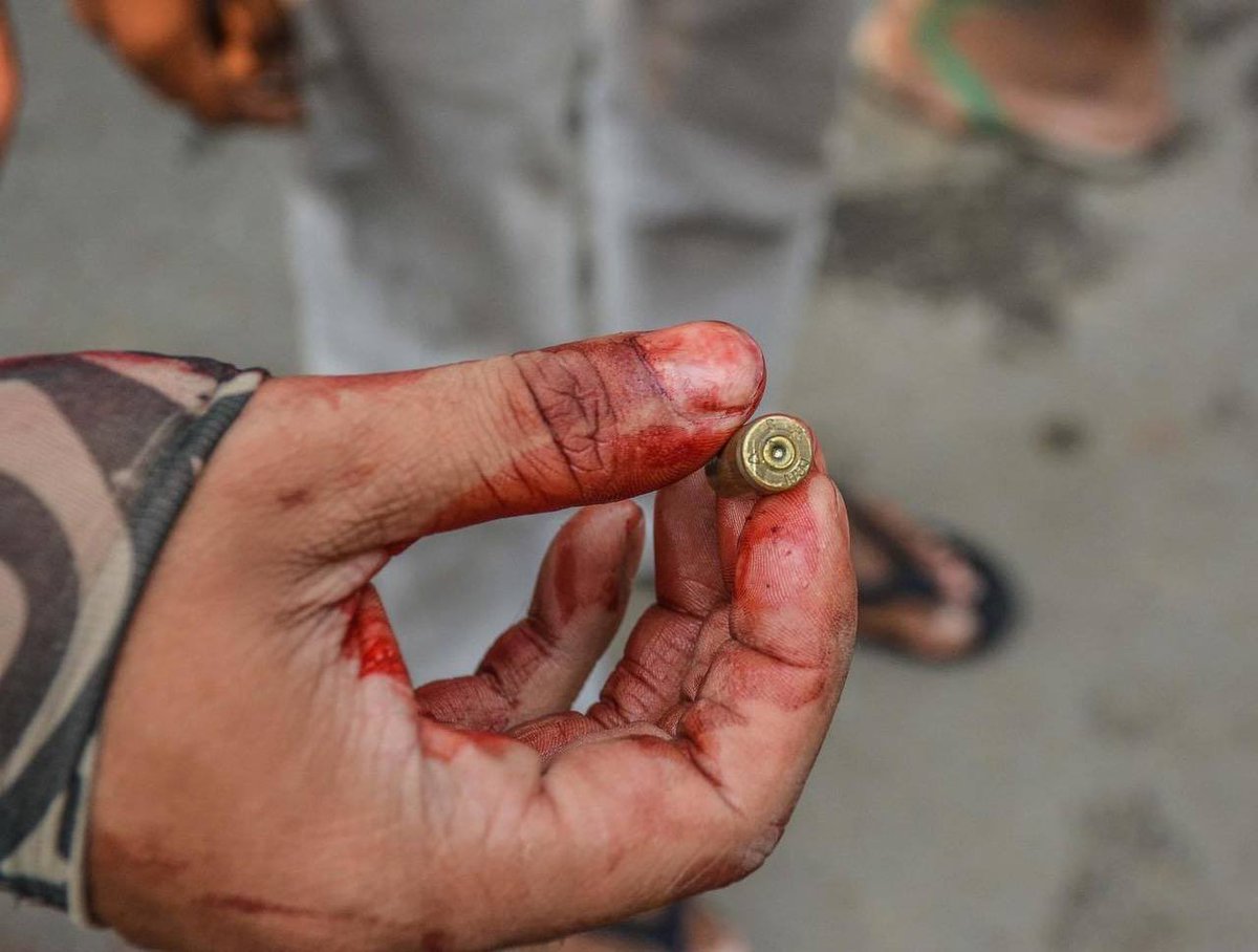 hmmo_sh's tweet photo. Tw// blood 
Mandalay, AungMyayTharSan strike was cracked down violently with live ammunitions by military junta forces. Many were injured reportedly.
#Mar27Coup #WhatsHappeningInMyanmar https://t.co/Lp2bRYv6r9