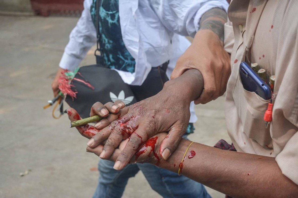 hmmo_sh's tweet photo. Tw// blood 
Mandalay, AungMyayTharSan strike was cracked down violently with live ammunitions by military junta forces. Many were injured reportedly.
#Mar27Coup #WhatsHappeningInMyanmar https://t.co/Lp2bRYv6r9