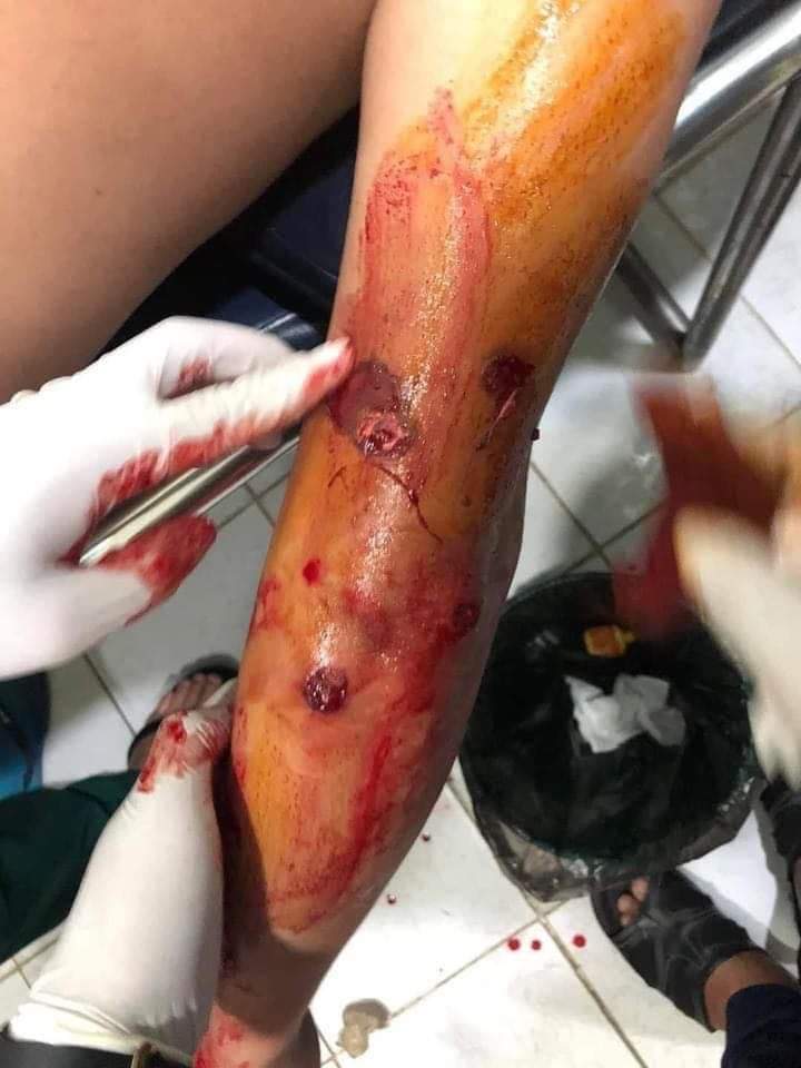 Tw // Blood
Myitkyina, Kachin: Anti-Fascist Revolution movement general strike by Myitkyina protestors started since 6am this morning. At 8 am, Terrorists brutally dispersed the crowd - at least 3 are injured and 30 abducted. #WhatsHappeninginMyanmar #AntiFascistRevolution2021