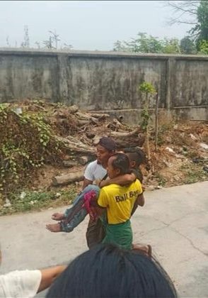 shafiur's tweet photo. #Mar27Coup Insein Township, Yangon

Unspeakable violence all over Myanmar today.  This person shot in the leg

#AntiFascistRevolution2021 #WhatsHappeningInMyanmar https://t.co/UhSyOLVMIm