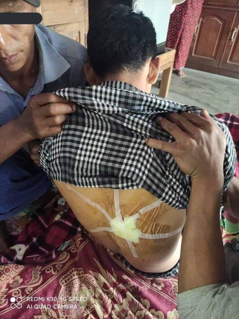 Tw // death
Hopin, Mohnyin Tsp, Kachin: Protestors were just started gathering when the crowd’s violently cracked down. One man was shot Dead and 4 female were abducted this morning. Heavy repression nationwide seen on this #AntiFascistRevolution2021 . 
#WhatsHappeningInMyanmar