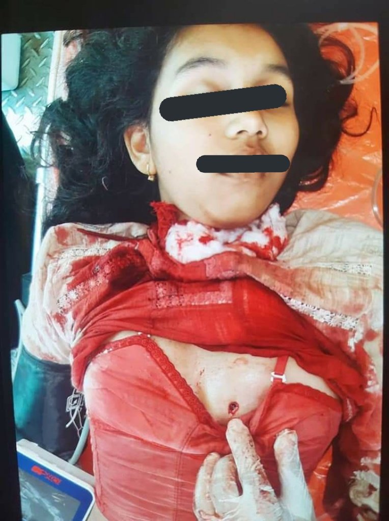 rylee_pm's tweet photo. Tw // blood // death
#AntiFascistRevolution2021
A girl (she's still in grade 7) from #Thila city died after being shot in her own house by Junta terrorists.
Rest in peace nyima Pan Ei Phyu.
#WhatsHappeningInMyanmar
#Mar27Coup https://t.co/u9AeeGkyua