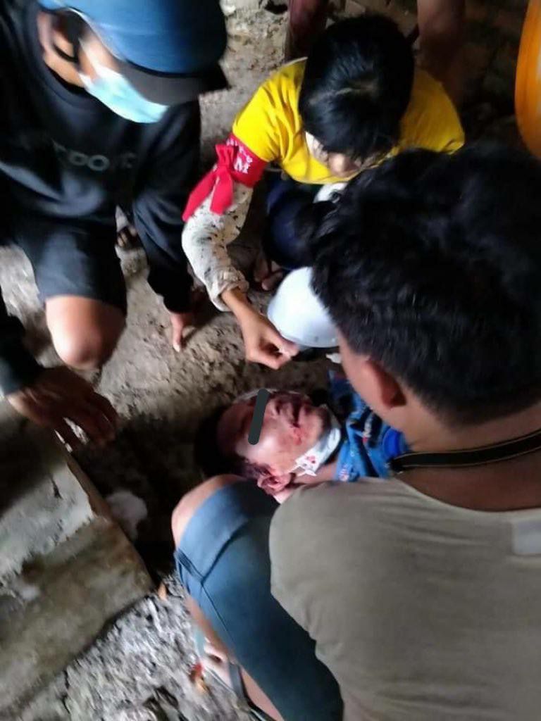 tw // graphic content⚠️
In DAIK-U, 3 civilians got injured and one announced dead due to terrorist group(SAC)'s violent shooting to unarmed protestors with live ammos, machine gun &amp; tear gas.

ANTIFASCIST REVOLUTION
#AntiFascistRevolution2021
#Mar27Coup
#WhatsHappeningInMyanmar