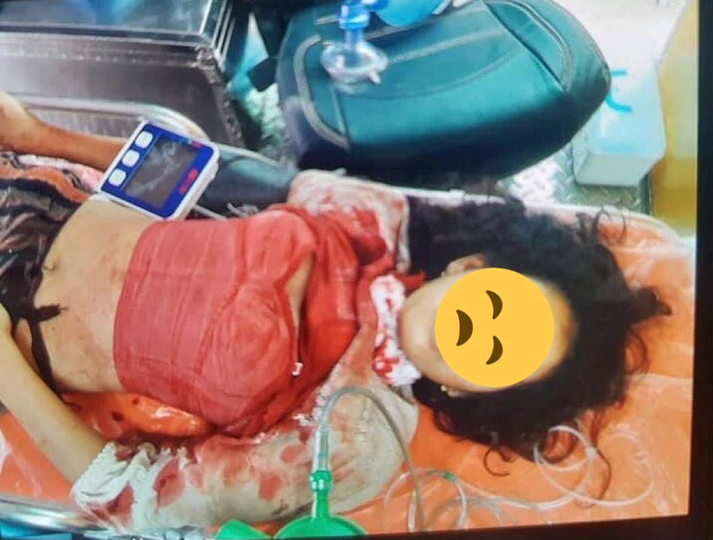 Near Bekan market, a 14-year-old girl staying at her home was shot dead. Her name was Pan Ei Phyu. May you not be born in such a country in your next life[or]May you have a life without such misfortunes in your next life.
ANTIFASCIST REVOLUTION
#Mar27Coup
#WhatsHappeningInMyanmar