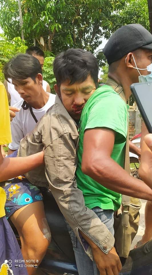 Dawei, Tanintharyi Region:

• a civilian was shot dead by Terrorists (#Myanmar security forces) in Kyun Hmwe Ward, 8th Street.

#WhatsHappeningInMyanmar #AntiFascistRevolution2021 #Mar27Coup #MilkTeaAlliance