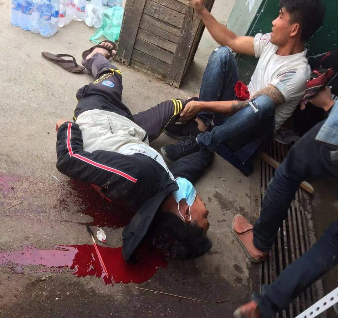 bg_rubydd's tweet photo. Tw // blood
Today in #Muse, one person was shot by the terrorist shootings. His condition ain't good.
ANTIFASCIST REVOLUTION
#AntiFascistRevolution2021
#Mar27Coup
#WhatsHappeningInMyanmar https://t.co/HEjj9D6pVu