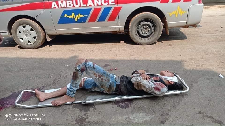 A local journalist in Kyaikhto township, Mon State got gunshot in leg and a lot of injures when he was on ground reporting today. Around 11:30Am.
#WhatsHappeningInMyanmar