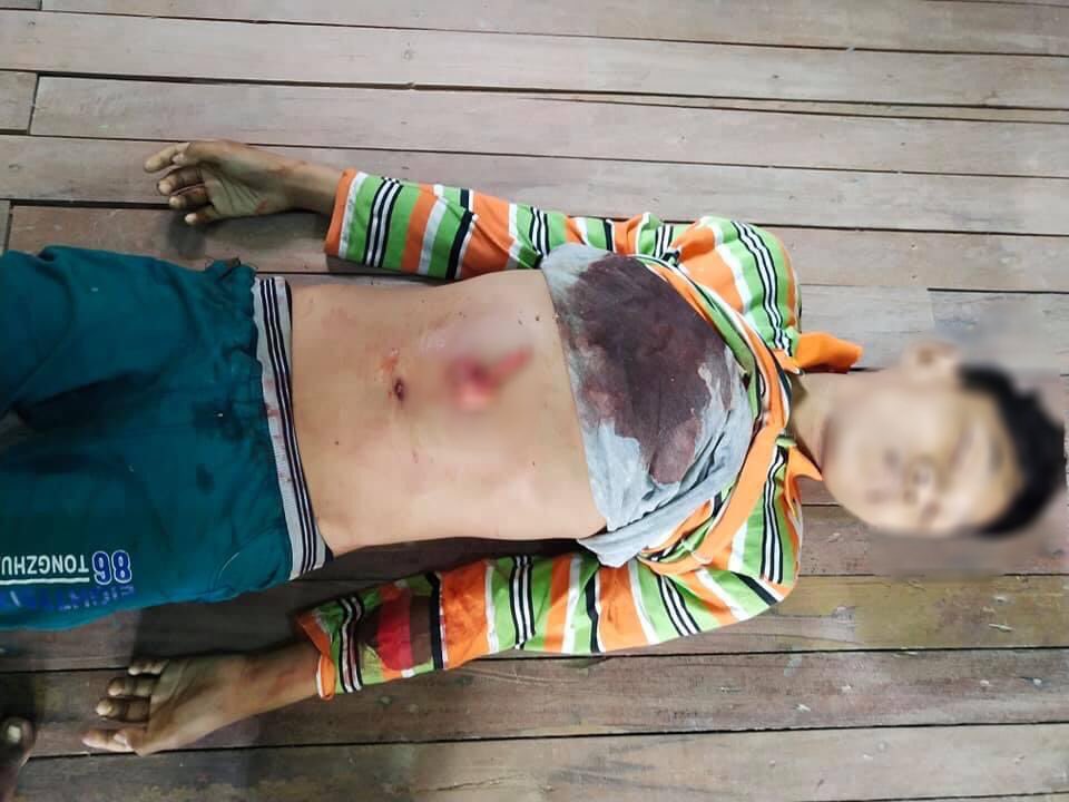 MayThaeHnyar's tweet photo. tw // death
Approx 13yrs old boy was shot DEAD in the abdomen by Terrorists today in #ShweBo city. He was just staying at home &amp; the bullet went through the window &amp; hit him
#AntiFascistRevolution2021
#Mar27Coup
#WhatsHappeningInMyanmarsave
#SaveChildren #ViolenceAgainstChildren https://t.co/CsmZXTjLzm