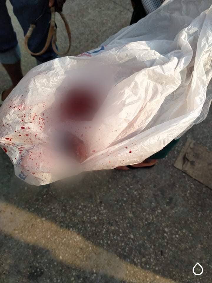 In Hlaing, #Yangon, a civilian was shot dead and his lungs drop out on the street. The second photo is the drop-out lungs of the person.
ANTIFASCIST REVOLUTION
#AntiFascistRevolution2021
#Mar27Coup
#WhatsHappeningInMyanmar