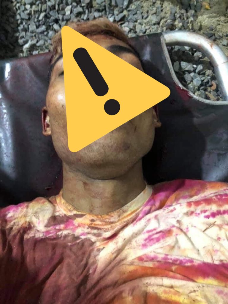 maythumyint004's tweet photo. ***GRAPHICS TOO SENSITIVE ***
Death cases in #Mandalay caused by military terrorists today, #Mar27Coup. Deaths still rising and rising.Most people got headshots, and other critical deadly shots which cause to die on spot
#WhatsHappeningInMyanmar 
#AntiFascistRevolution2021 https://t.co/9maCQAkift