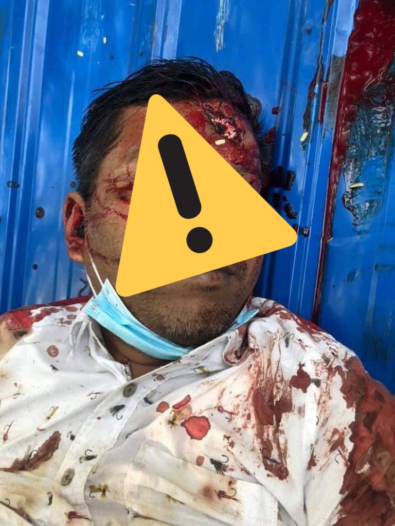 maythumyint004's tweet photo. ***GRAPHICS TOO SENSITIVE ***
Death cases in #Mandalay caused by military terrorists today, #Mar27Coup. Deaths still rising and rising.Most people got headshots, and other critical deadly shots which cause to die on spot
#WhatsHappeningInMyanmar 
#AntiFascistRevolution2021 https://t.co/9maCQAkift