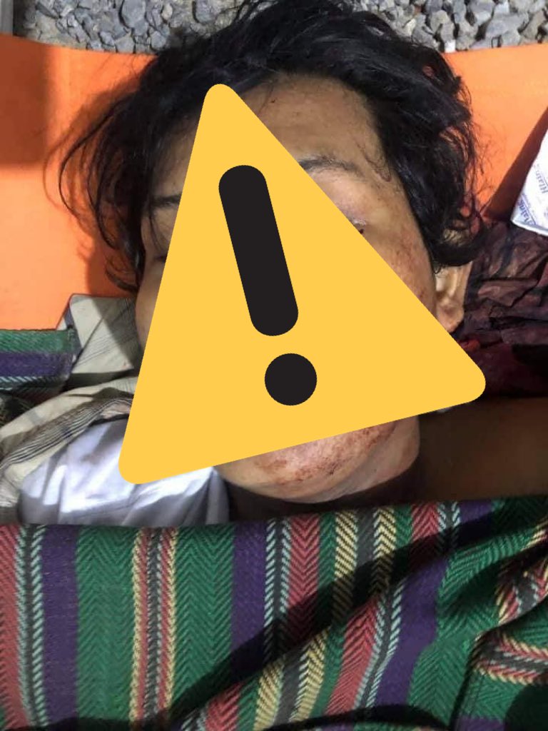 maythumyint004's tweet photo. ***GRAPHICS TOO SENSITIVE ***
Death cases in #Mandalay caused by military terrorists today, #Mar27Coup. Deaths still rising and rising.Most people got headshots, and other critical deadly shots which cause to die on spot
#WhatsHappeningInMyanmar 
#AntiFascistRevolution2021 https://t.co/9maCQAkift