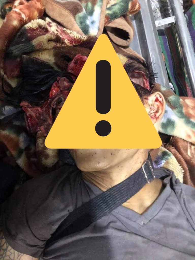 maythumyint004's tweet photo. ***GRAPHICS TOO SENSITIVE ***
Death cases in #Mandalay caused by military terrorists today, #Mar27Coup. Deaths still rising and rising.Most people got headshots, and other critical deadly shots which cause to die on spot
#WhatsHappeningInMyanmar 
#AntiFascistRevolution2021 https://t.co/9maCQAkift
