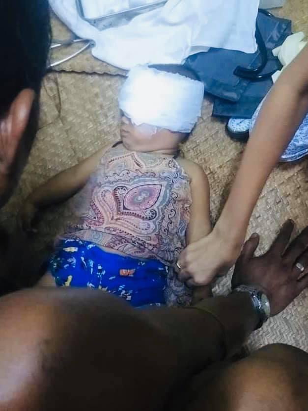 An innocent 1 year old baby was shot in the eye with Rubber bullet by Mayangone (2) ward ,Yangon. 
This is beyond limit. They are even attacking children and severals are dying. We need HELP. #CrimesAgainstHumanity 
#WhatsHappeningInMyanmar #Mar27Coup #AntiFascistRevolution2021