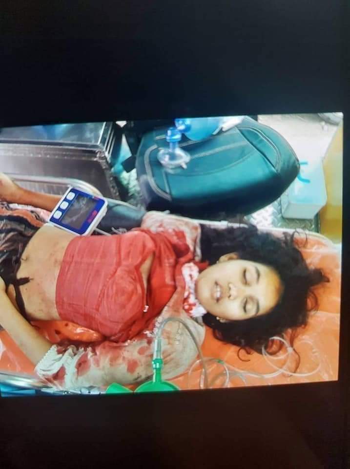 Sheila30249611's tweet image. #howmanydeadbodyneededforUNtotakeaction  
#whathappeninginmyanmar 
#Match27
#fuckingmyanmarmilitarycoup 
1:45