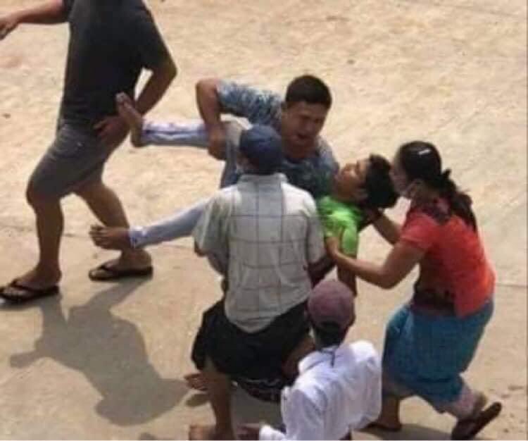 Tw // blood 

Location - Pathein 

Military sponsored thugs fired both rubber &amp; live AMMO at the unarmed civilians.Many civilians were shot &amp; some are in critical condition. 

#WhatsHappeningInMyanmar #Mar27Coup