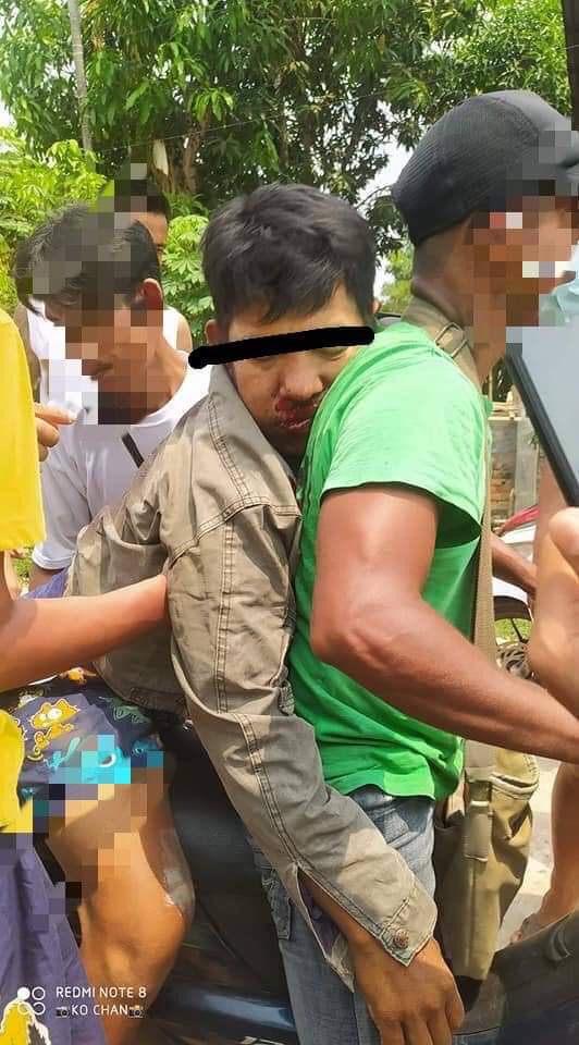 Dawei: ONE was shot DEAD by terrorists. They are roaming around the whole city since morning and fired live rounds to whoever on sight. Nationwide massacre is committed by these cold blooded terrorists since early morning. #WhatsHappeningInMyanmar #AntiFacistRevolution2021