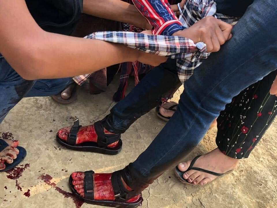MerriesMay's tweet photo. Tw// blood // death

1 killed in Hpa Do township; Military intentionally shot at peaceful protest this morning on Mar 27 n killed 1 victim. 3 other who were shot in leg, 
ANTIFASCIST REVOLUTION
#AntiFascistRevolution2021
#Mar27Coup
#WhatsHappeningInMyanmar
@USEmbassyBurma @UN_HRC https://t.co/DyYlzCjbxQ